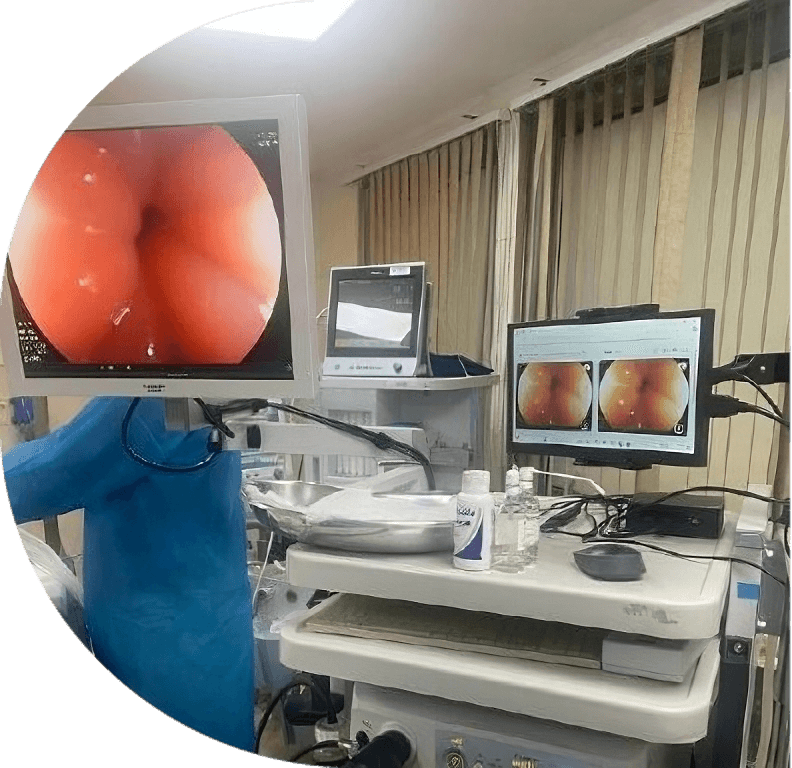 Sala de endoscopía con IMAVEN mostrando en un monitor las imágenes capturadas